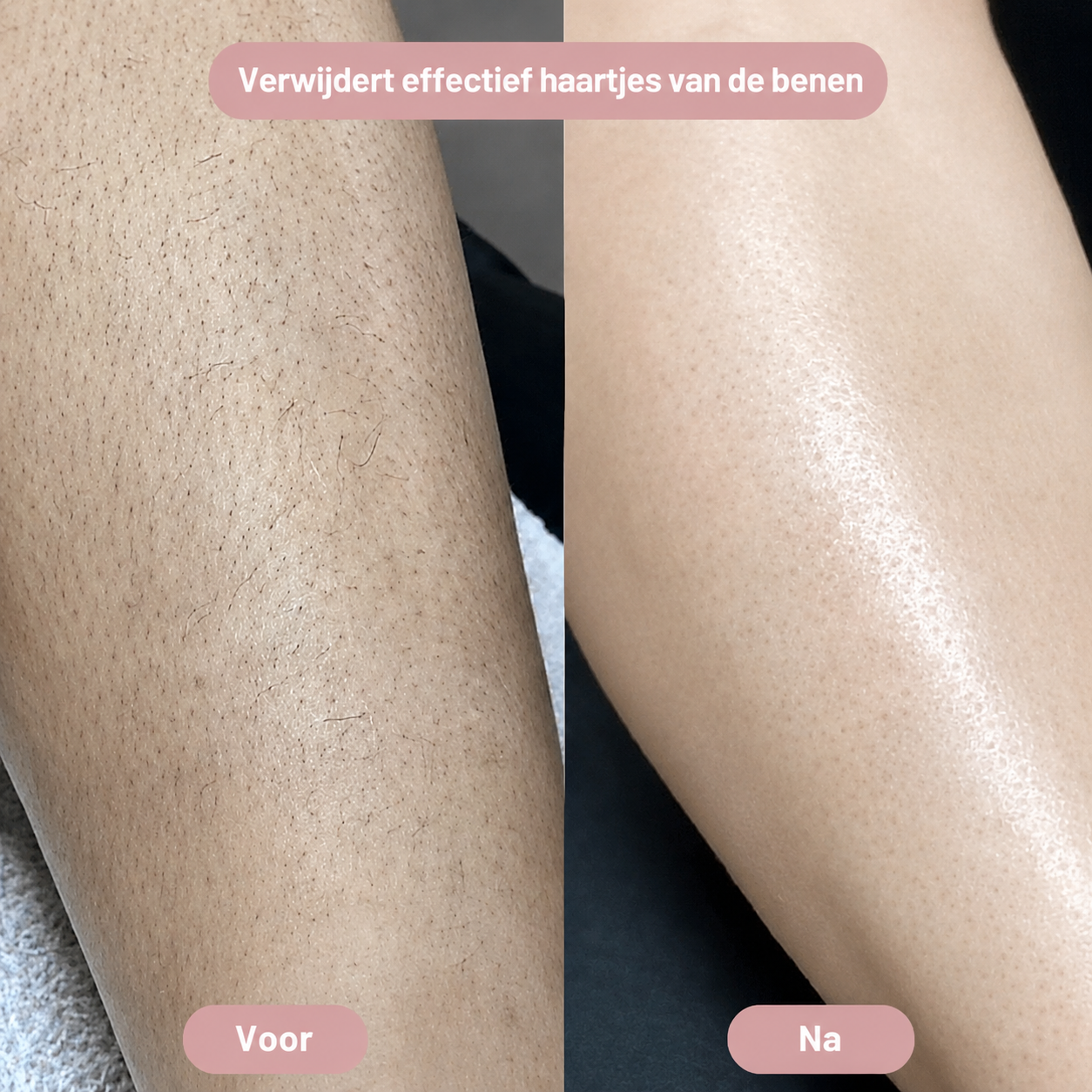 SilkySkin – Intiem scheren zonder irritatie